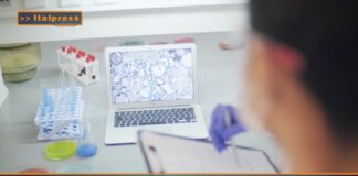 TG AGRIFOOD del 8 gennaio 2025 – Microplastiche, nuovo studio su pesci e crostacei  (Video)